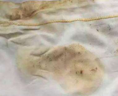 茶渍怎么去除